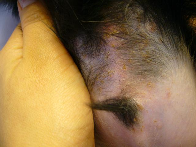 かゆいんですぅ～