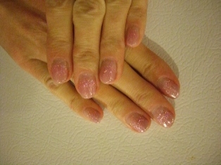 カルジェル・４