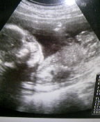 baby080107.jpg