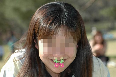 花粉症２