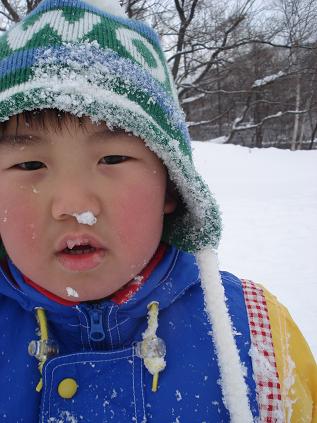 鼻に雪つまってるよー