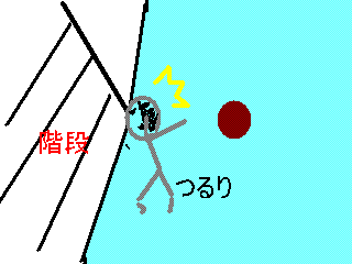 lglgi
