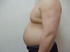 125kg 1年前　ダイエット　画像