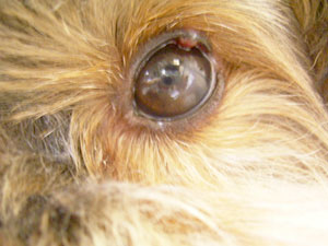 マイボーム腺炎