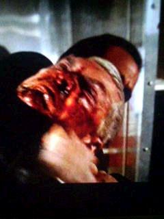 ペン、絞められる