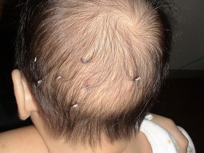 ちょんちょりんこ