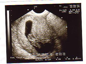 10ｗ3ｄ