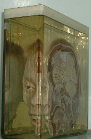 死体博物館 便利屋総本店 楽天ブログ 死体博物館 便利屋総本店 楽天ブログ