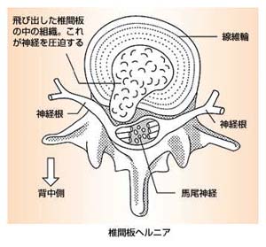 へるにあ～ん