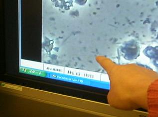 口内菌を電子顕微鏡で覗く
