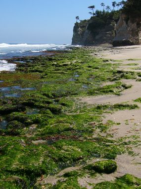 ささきの出っ歯