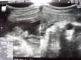 31w