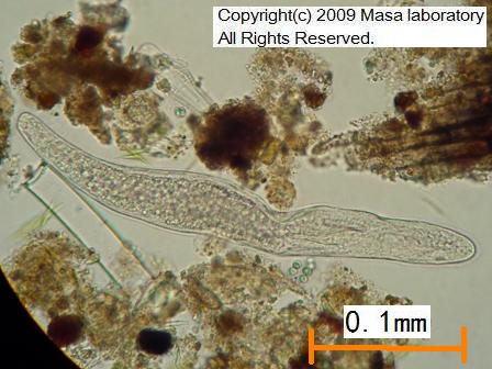 線虫の一種
