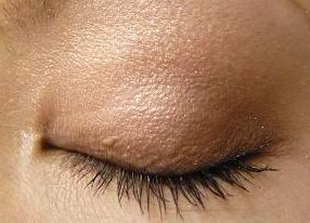 アイズＥＸ－０４をつけた目