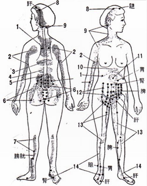 更年期障害（全身図）.