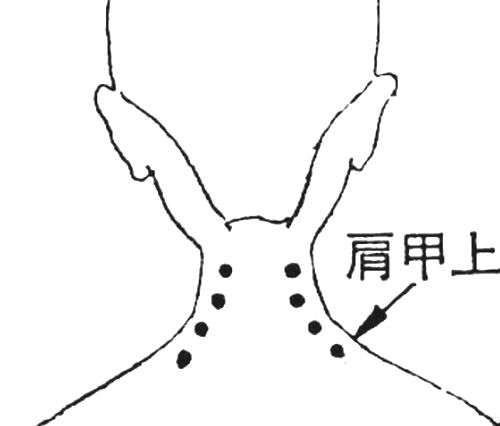 後頚部のポイント