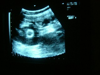 左中央の丸いの赤ちゃんだって！！