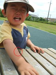 りゅう　小バエが苦手