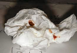 dead bed bugs 3.JPG
