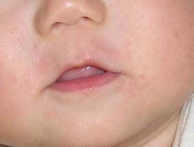 アレルギー 湿疹 ｓｉｍｐｌｅ ｌｉｆｅ 1day1click 楽天ブログ