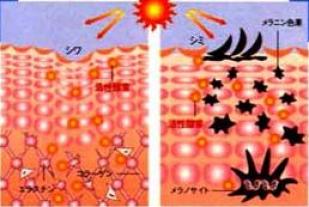 活性酸素のよる肌トラブル