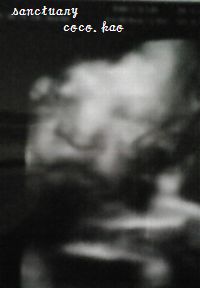 36w4d
