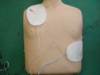 AEDの電極パッドの貼り方