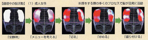 脳