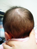４ヶ月児の頭部