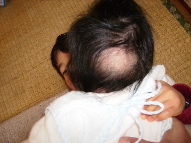 12月30日　はげちゃった