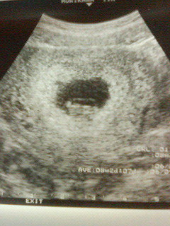 超音波１．２４