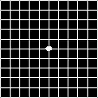 アムスラーグリッド