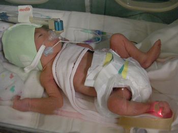 ＮＩＣＵ