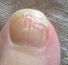 爪が割れてます！