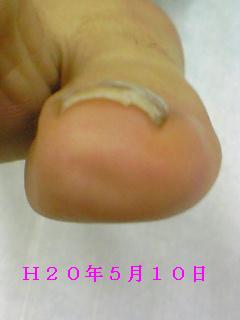 ２０．５．１０（５回目）