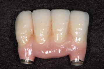 ガミー　その３（参考１）