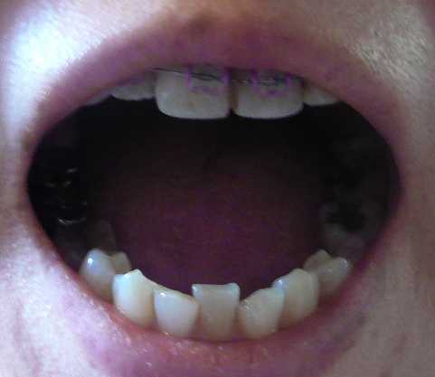 は、３０。１０