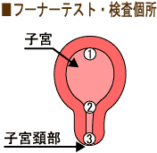 フーナーテスト検査箇所