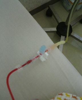 おっとっと！逆流