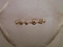 ベーネPGアイビー