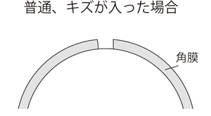 目-1