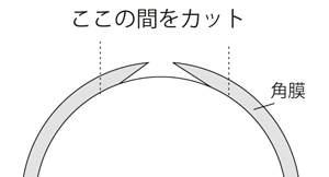 目-3