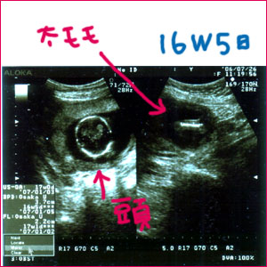 妊娠５ヶ月 なんとなく日記かも 楽天ブログ