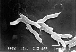 ピロリ菌の電子顕微鏡写真（古賀泰裕・東海大教授提供）