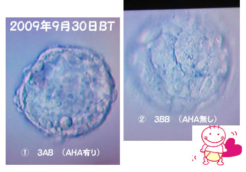 2009/9/30 胚盤胞（3AB・3BB)