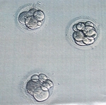 embryos - 2007