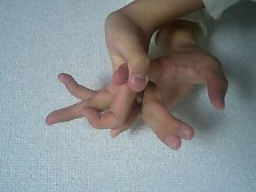 キリプレクイズ