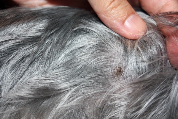 右脇腹にかさぶた