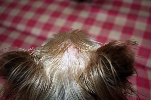 かさぶたとれる