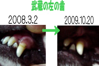 武蔵の左の歯２枚.jpg